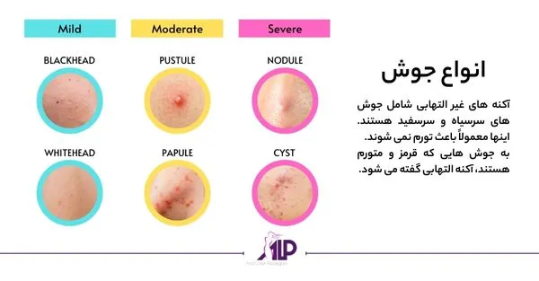 انواع جوش