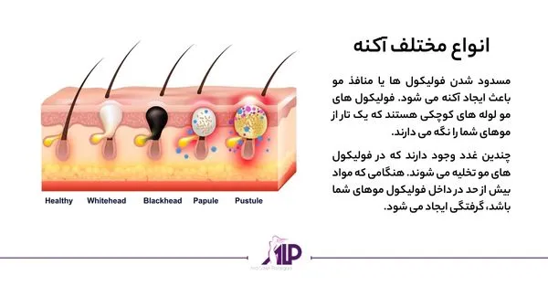 انواع جوش