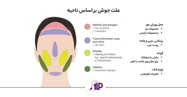 انواع جوش