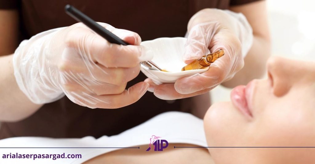 لایه برداری شیمیایی